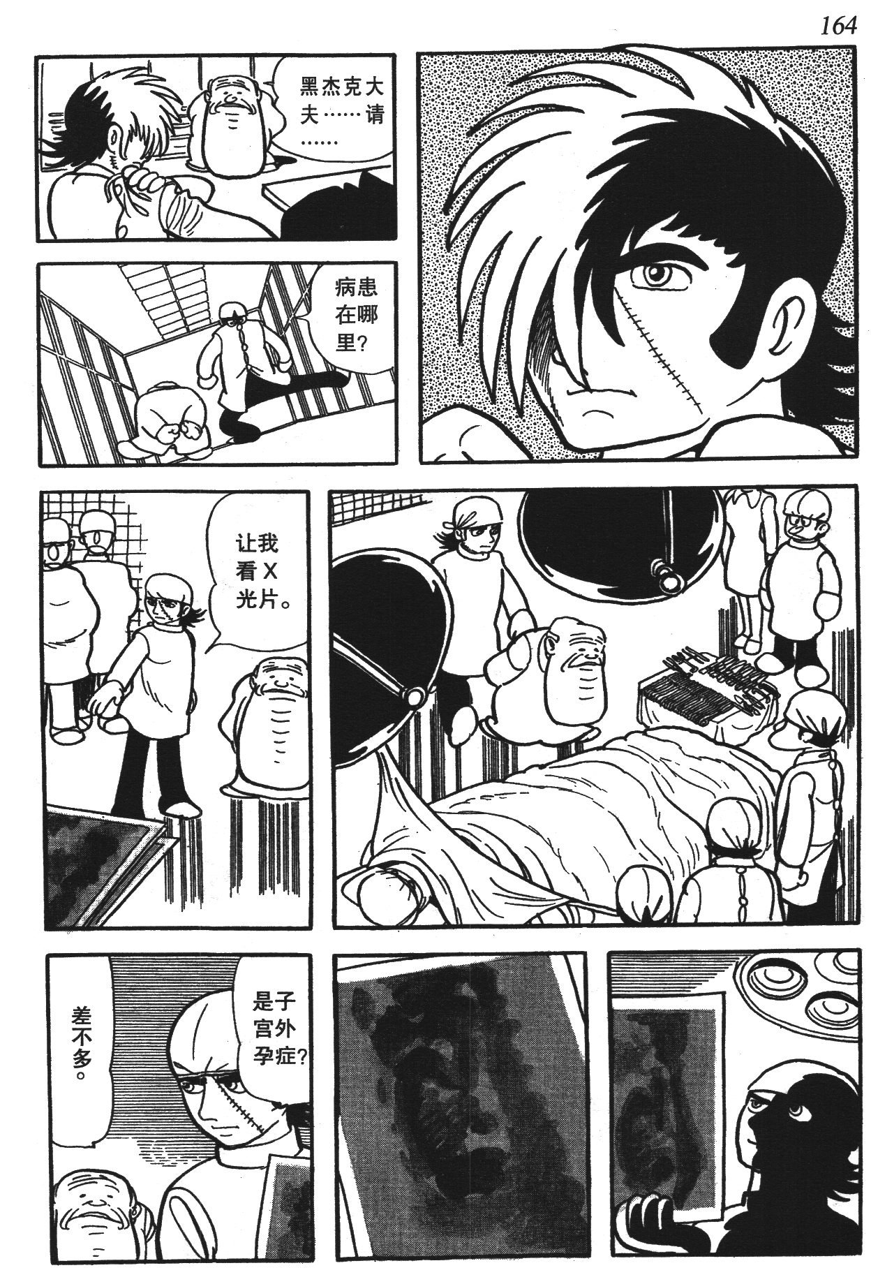 Page 158