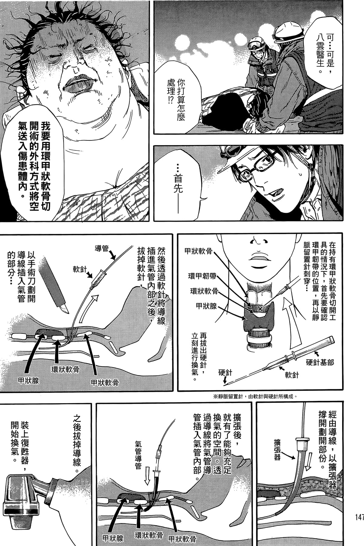 Page 148