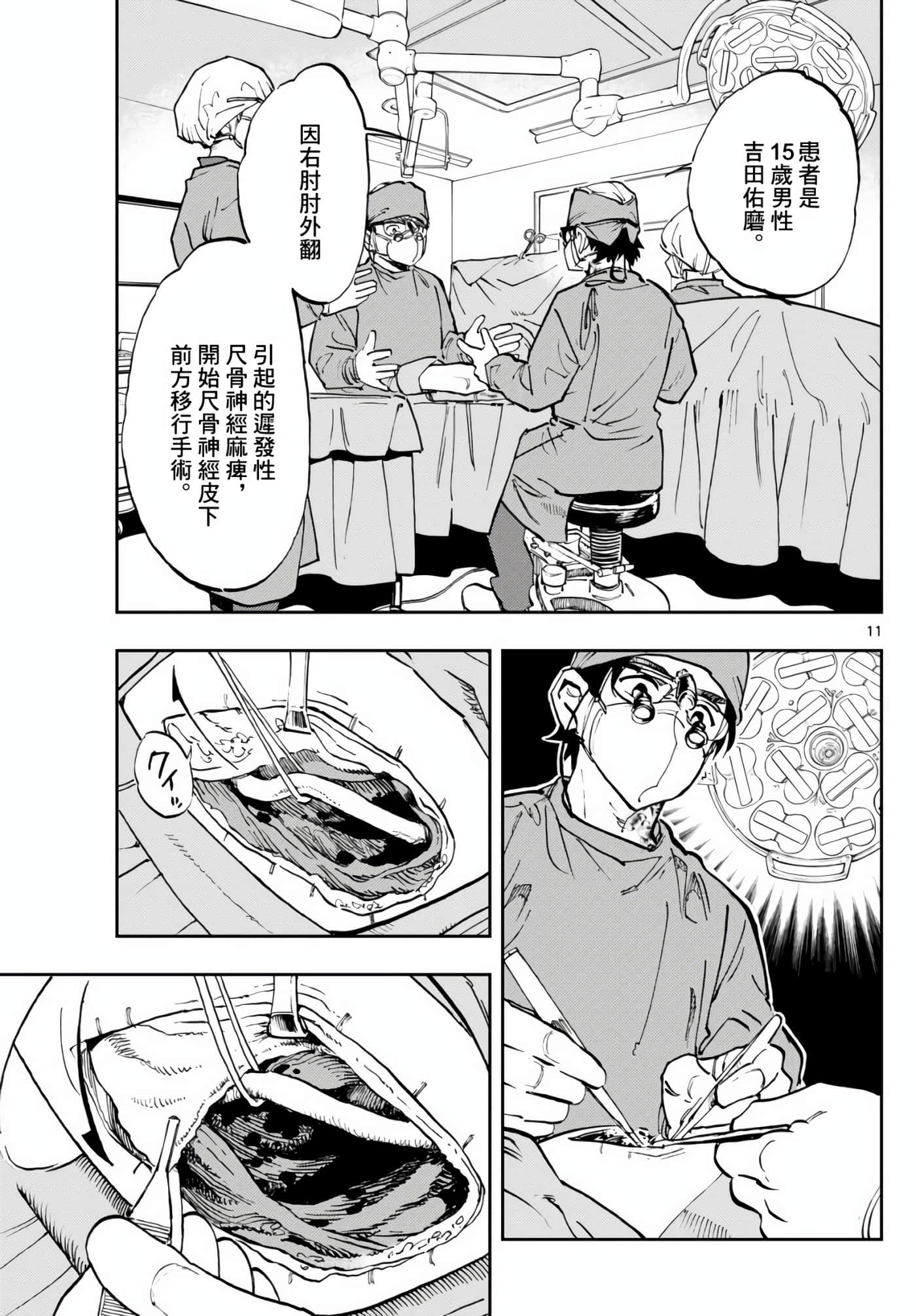 Page 11