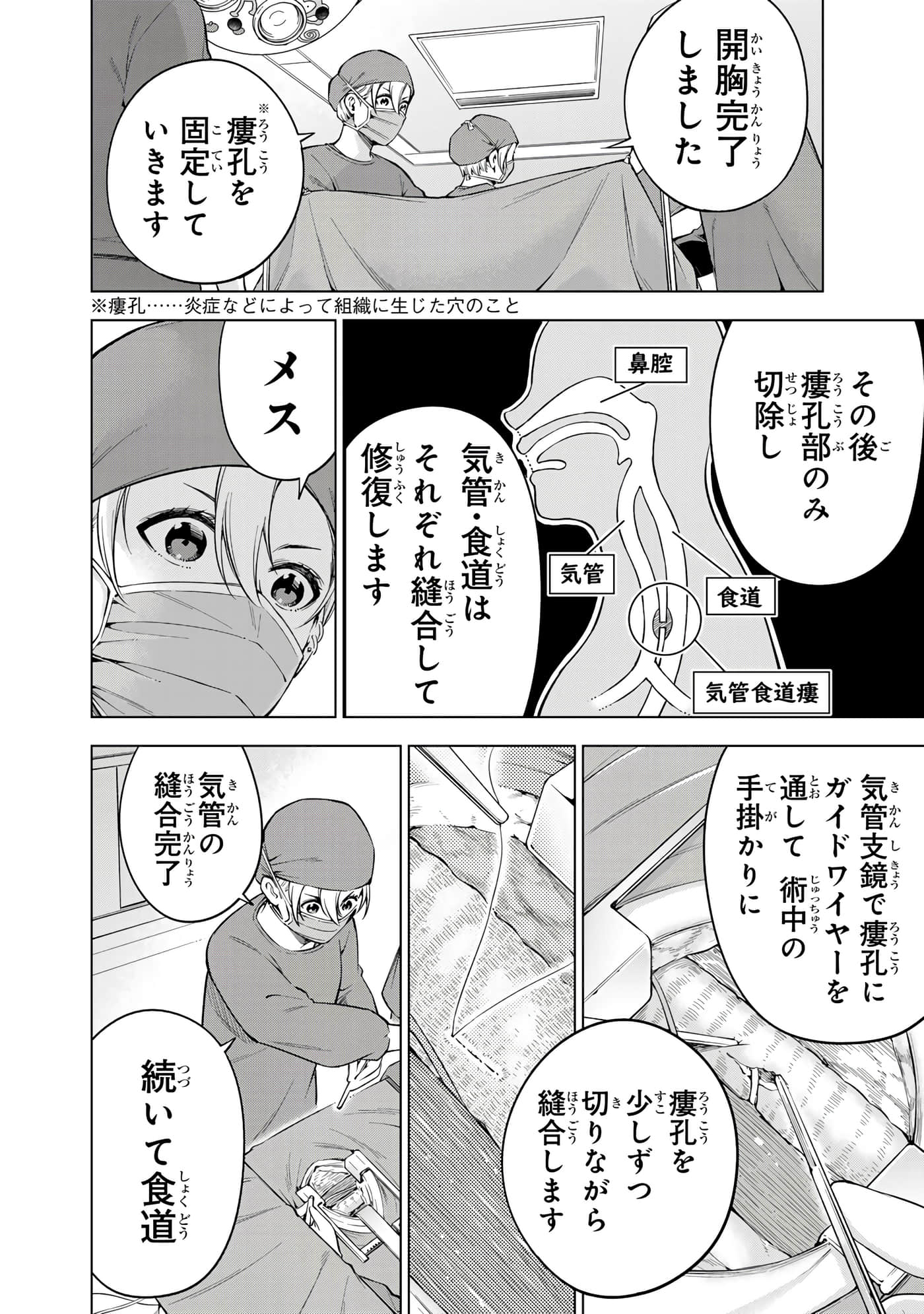 Page 113