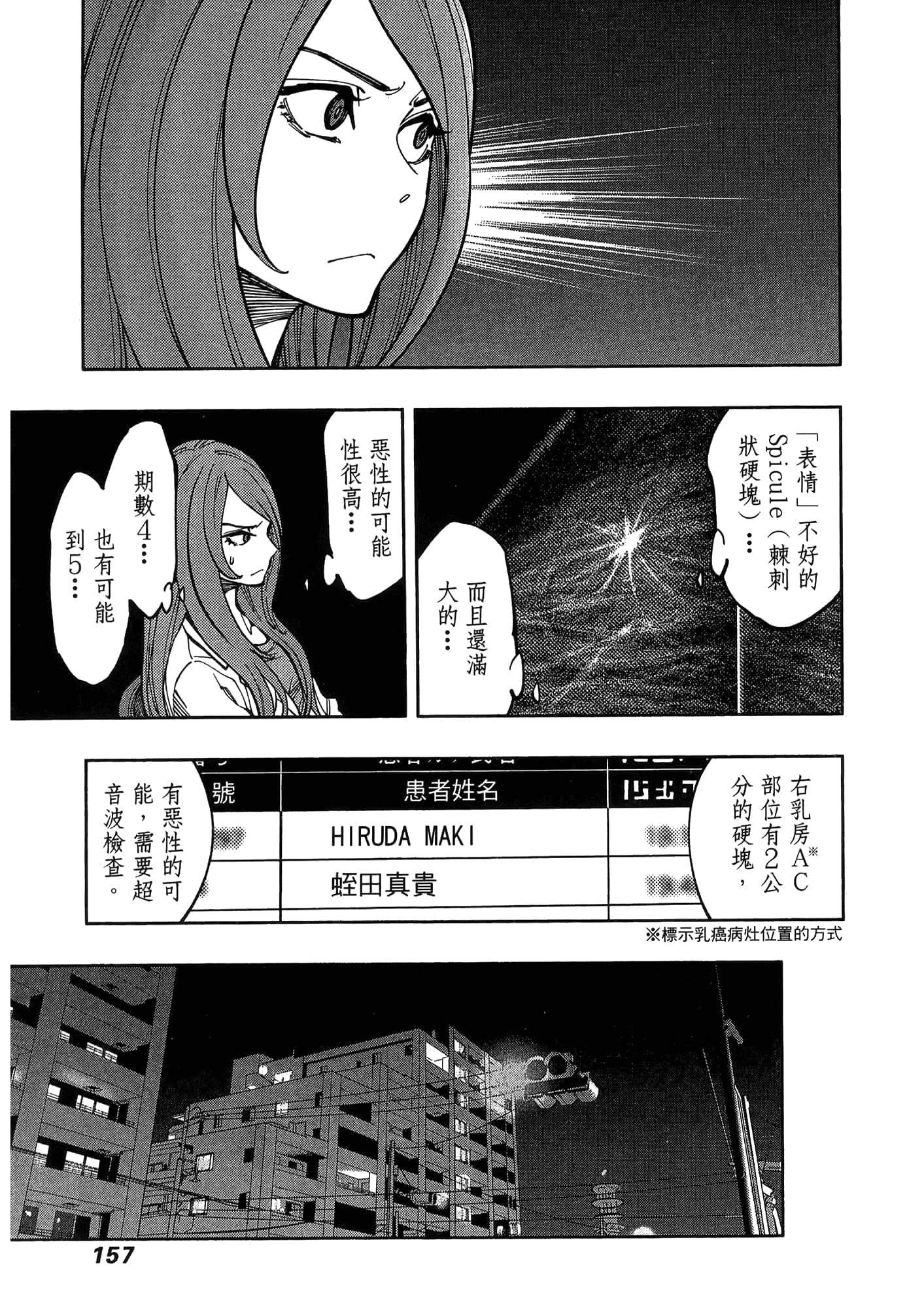 Page 161